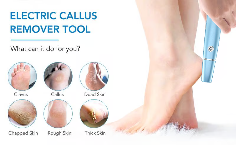 🔥LAST DAY SALE 49% OFF🔥Electric Feet Callus Remover⚡
