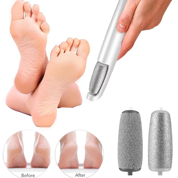 🔥LAST DAY SALE 49% OFF🔥Electric Feet Callus Remover⚡