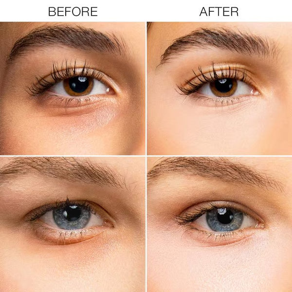 Limited-Time Offer⏰️Under-Eye Brightener Cream – Dark Circle Correction & Fine Line Smoothing