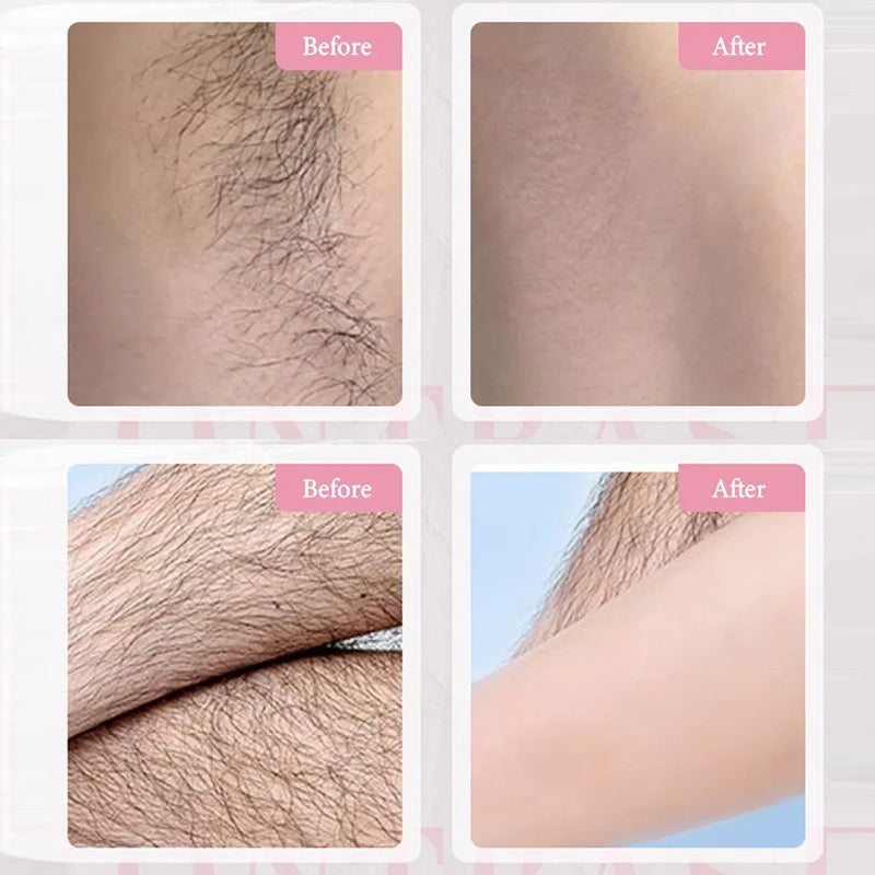 🎉Spring Hot Sale🎉Gentle & Effective Hair Removal Cream