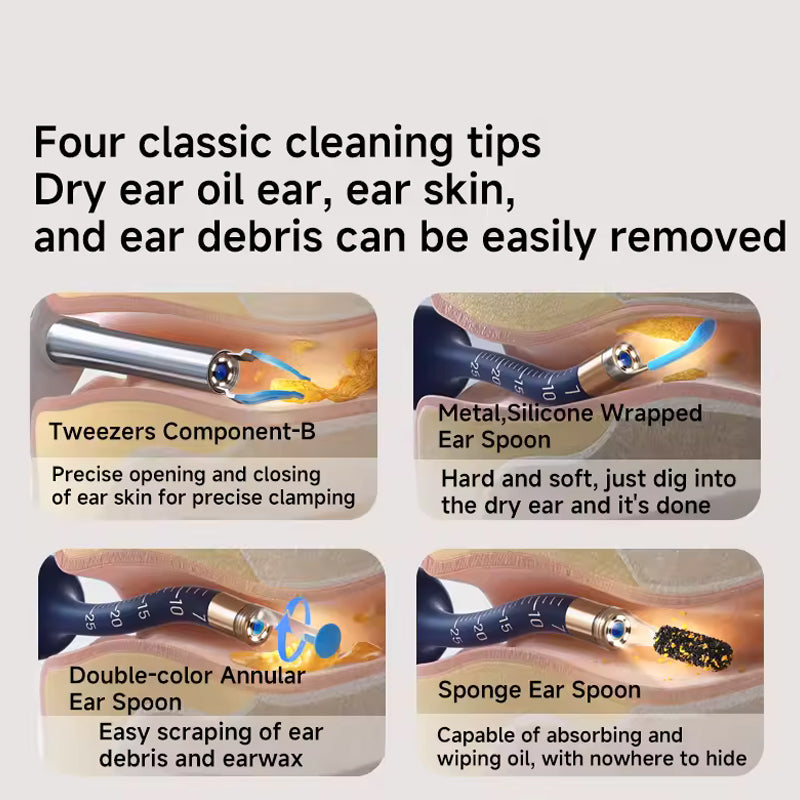 📣The safest tool for cleaning ears 😍 👂Visual Arc Ear Wax Removal Kit