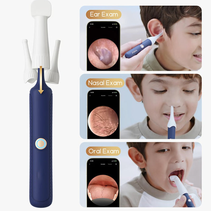 📣The safest tool for cleaning ears 😍 👂Visual Arc Ear Wax Removal Kit