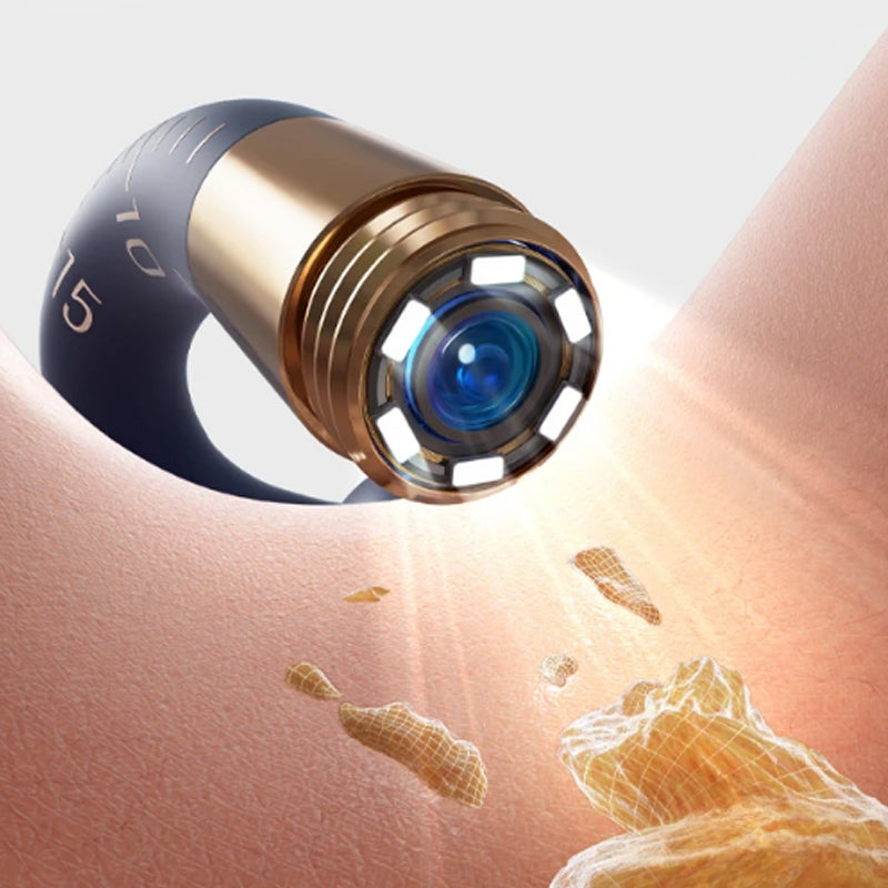 📣The safest tool for cleaning ears 😍 👂Visual Arc Ear Wax Removal Kit