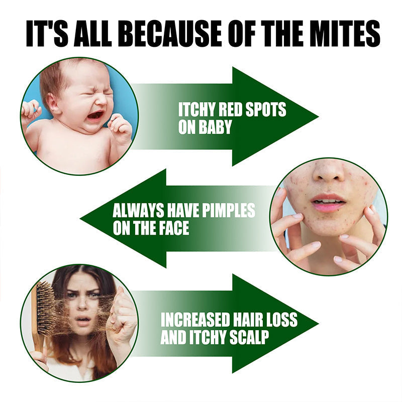 🔥Powerful Mite Remover Spray🐜  -  Gentle on Skin & Odor-Free, Ideal for Home and Garden 🌿🧴