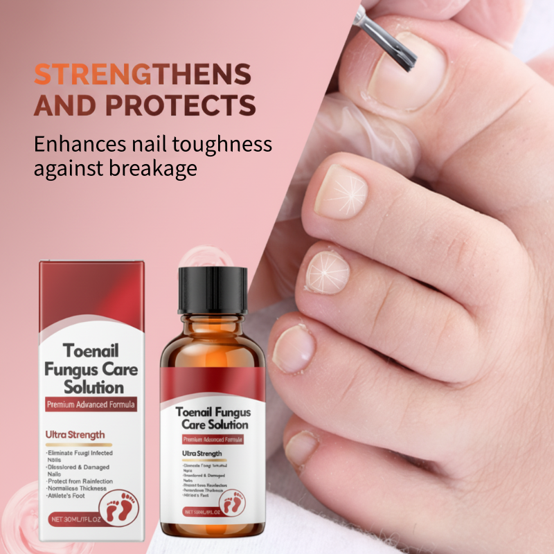 🔥Christmas Limited-Time Offer:50% OFF!!!🔥Nail Repair Essence for Damaged Nails