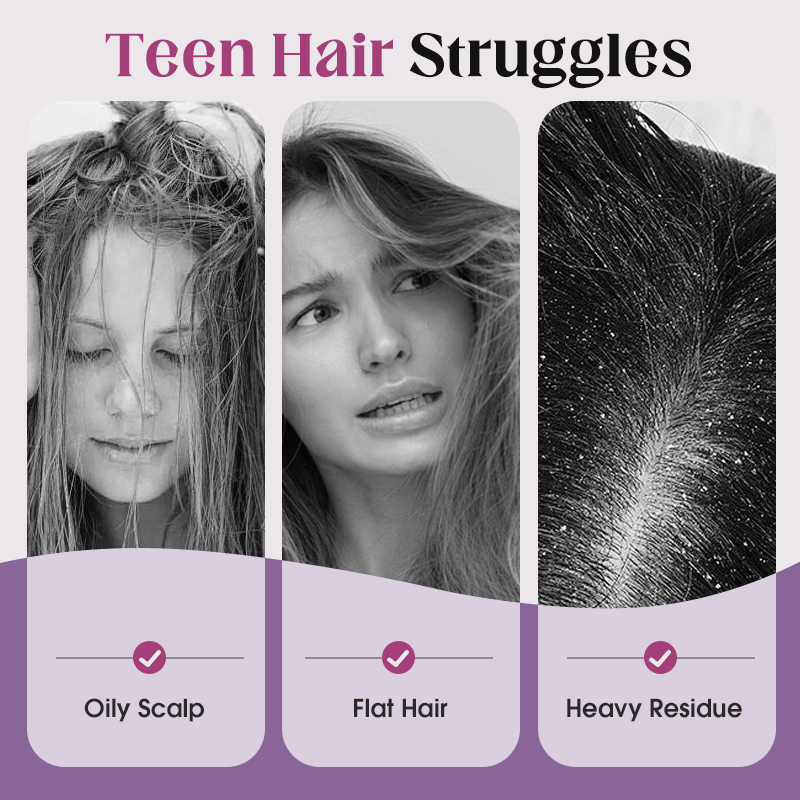 🔥2026 New Arrivals: 50% Off for a Limited Time!🔥Oil Control Volumizing Shampoo for Teens