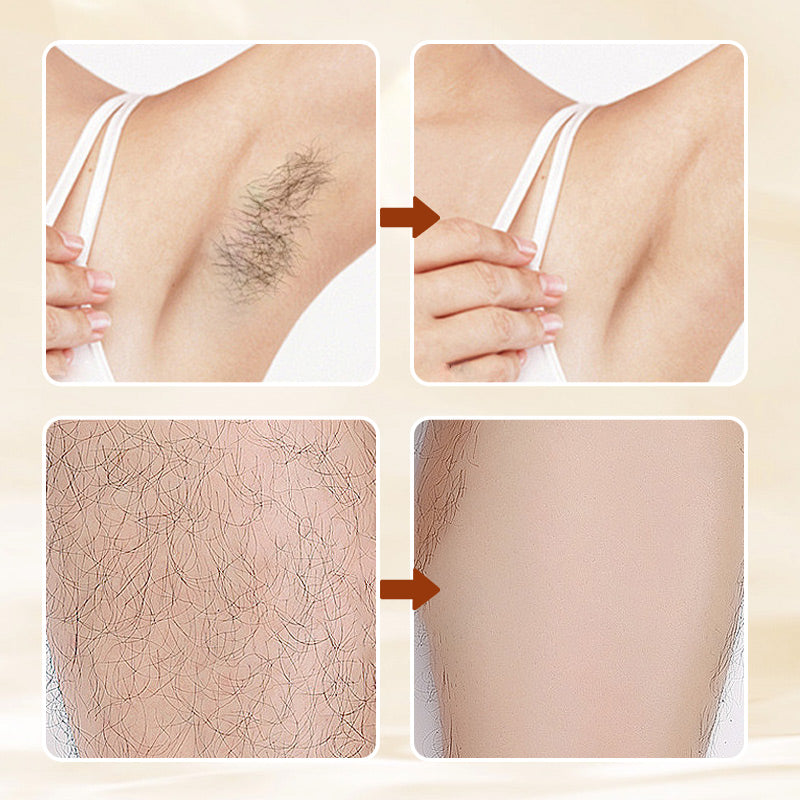Remove Hair Gently Instantly! Mild Aromatic Hair Removal Cream