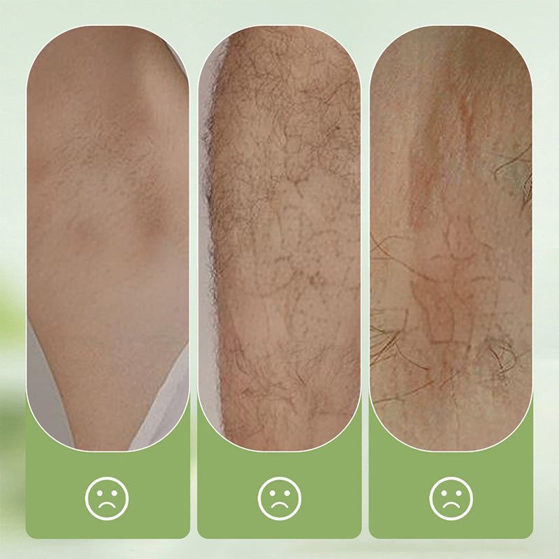 💥Large-size hair removal cream Gentle and non-irritating hair removal cream set (hair removal cream + razor) | Limited-time offer 🎁