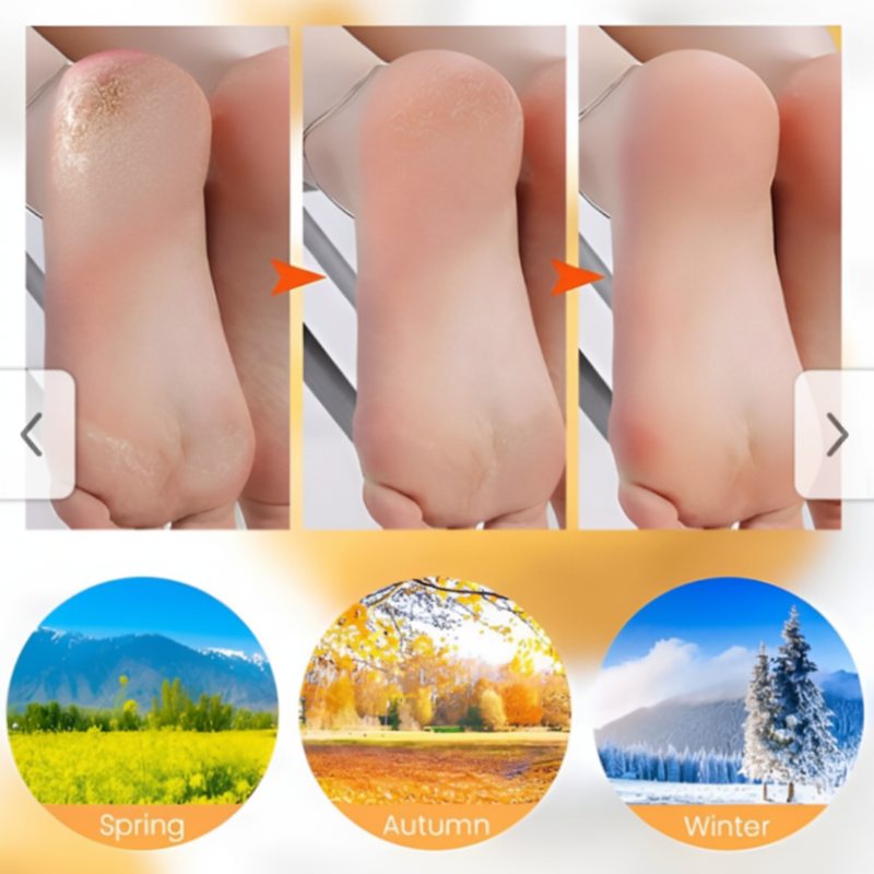 Silicone Moisturizing Heel Socks – Anti-Slip & Cracked Skin Repair