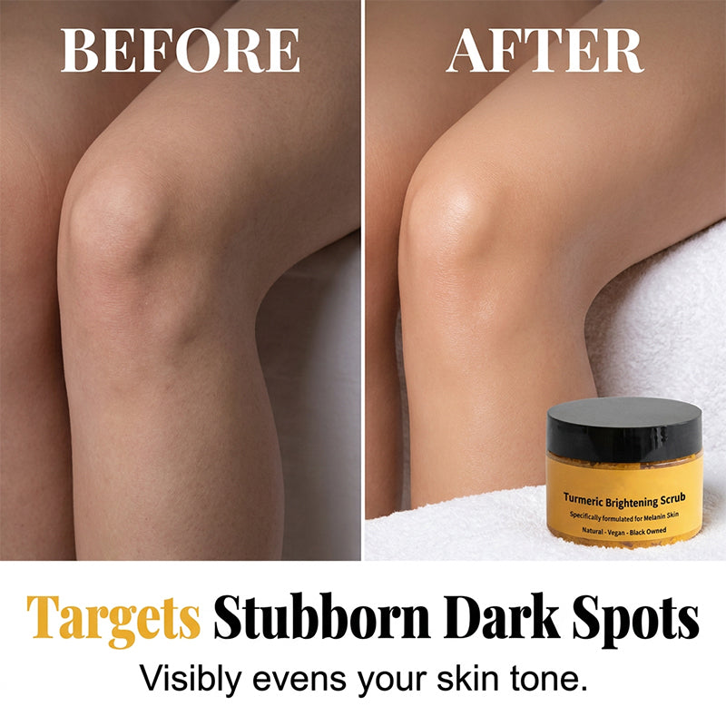 🥳2026 HOT SALE🥳Turmeric Body Scrub – Gentle Exfoliation & Dark Spot Corrector