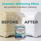 Whitening & Yellowing Remover Spray – Multi-Surface Instant Revival