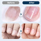 Herbal Nail Repair Spray – Quick-Dry & Nourishing