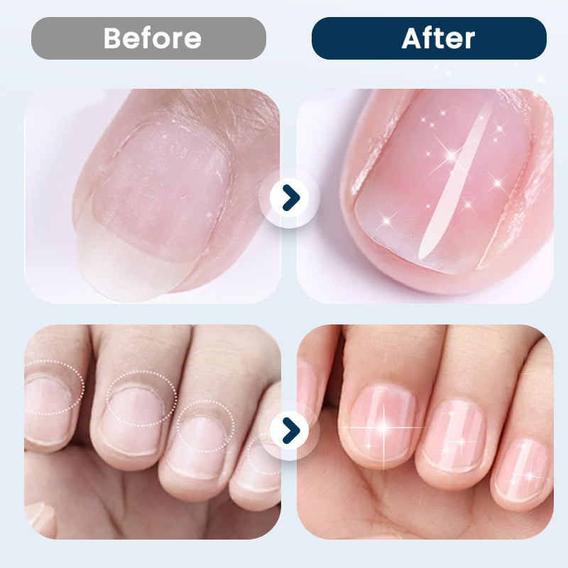 Herbal Nail Repair Spray – Quick-Dry & Nourishing