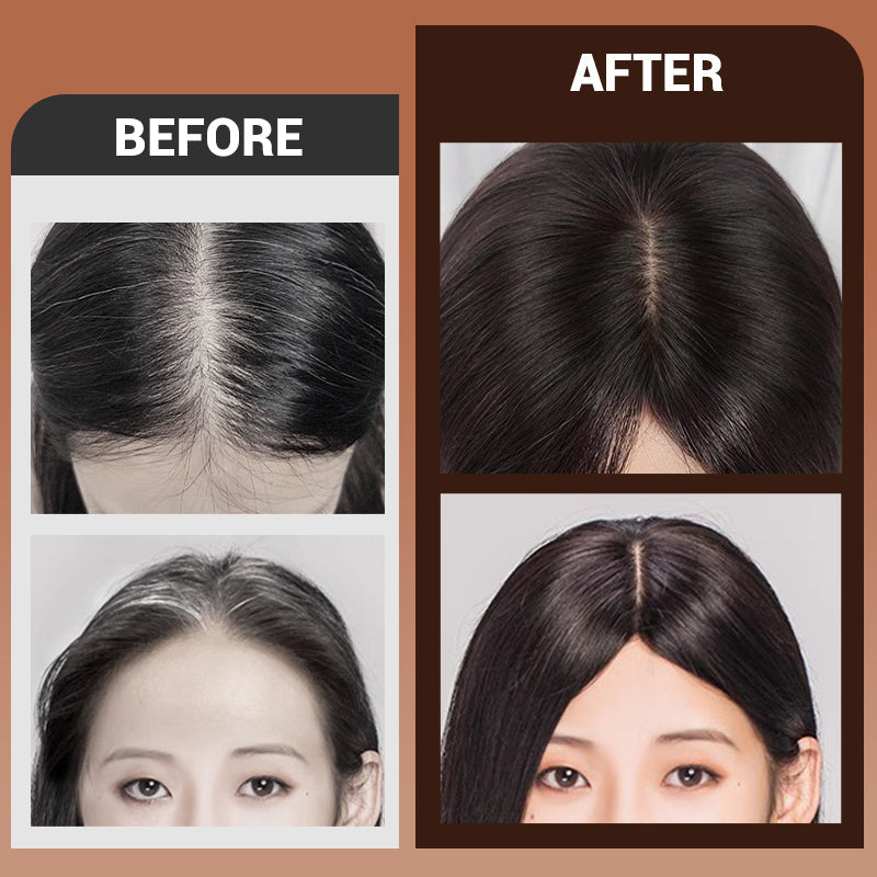 Clip-In Hair Topper – Realistic Scalp & Secure Fit
