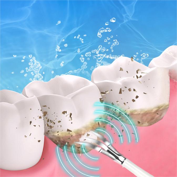 Ultrasonic Dental Cleaner – 5 Modes & LED Display for Professional Oral Care