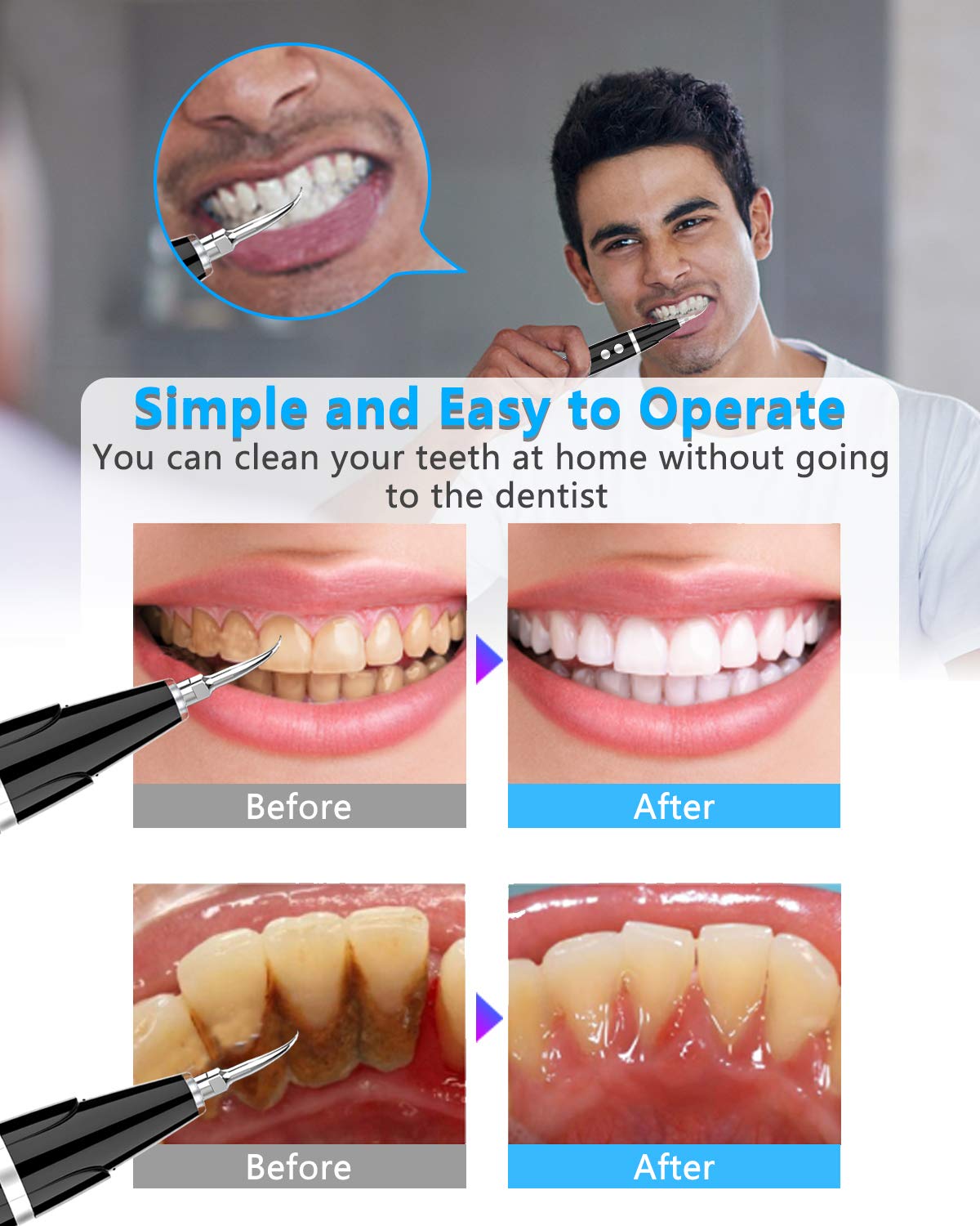 Ultrasonic Dental Cleaner – 5 Modes & LED Display for Professional Oral Care