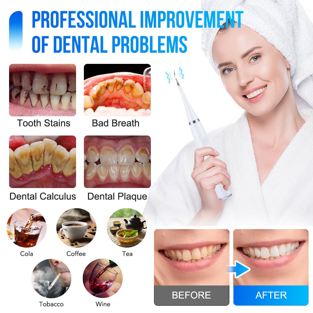 Ultrasonic Dental Cleaner – 5 Modes & LED Display for Professional Oral Care