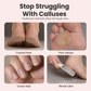 Professional Electric Callus Remover – 20K RPM & Safety Sensor Design