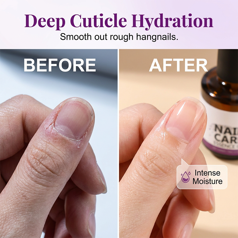 Nail & Cuticle Essence Oil – Strengthening & Hydrating Formula