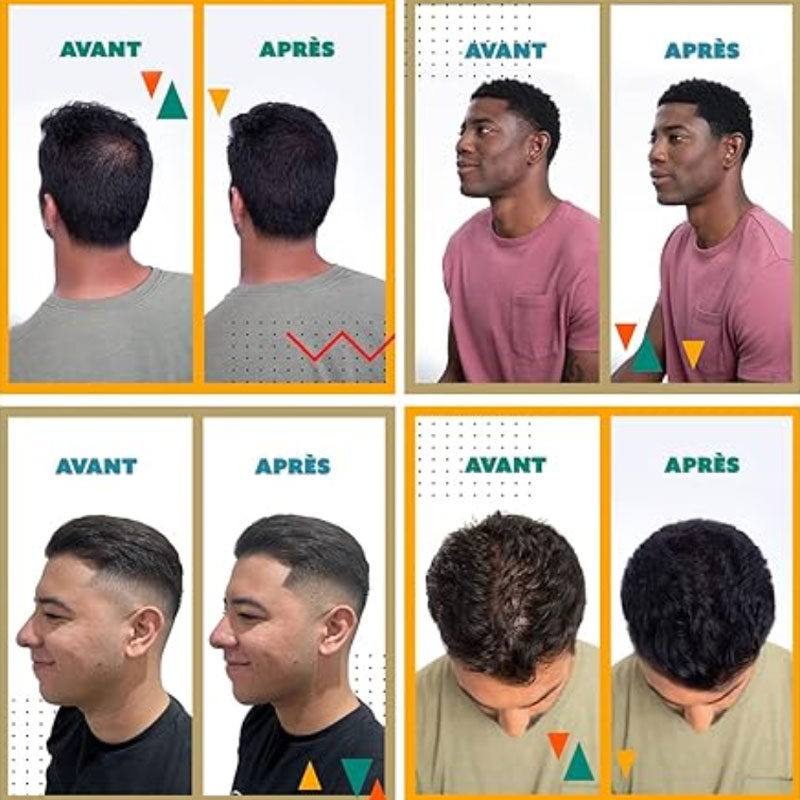 Hair Building Fibers – Instant Thickness & Waterproof Design, No More Bald Spots