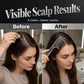 Apply Scalp Care Instantly! Precision Liquid Applicator Comb