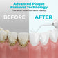 Floss Anywhere Instantly! No-Cord 230ml Water Flosser