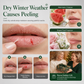 Moisturize Dry Lips Instantly! No-Crack 10-Piece Christmas Balm Set