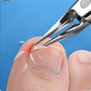 Trim Ingrown Toenails Instantly! German Steel Precision Nail Nipper